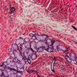 Gastrointestinal cancer in dogs Lab image showing GI cancer deterioration
